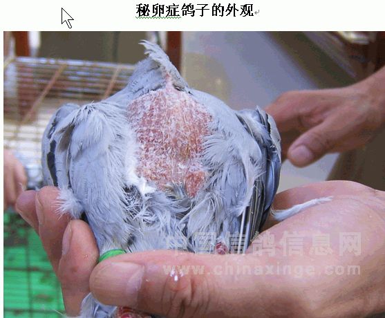 �Ÿ���ʯ֢��ͼ��