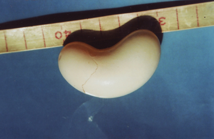 ������θ뵰�����(ͼ1)