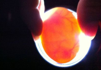 �ܾ�˫�Ƶ��ܳ�С����