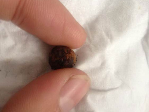 ��������� �˸�ˤ��ˮ������(ͼ)