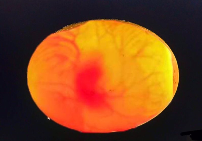 ���������޾�����